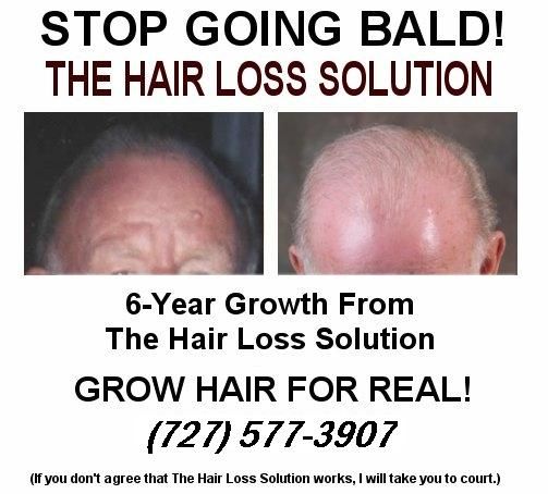 hair photo:stop hair loss naturally 