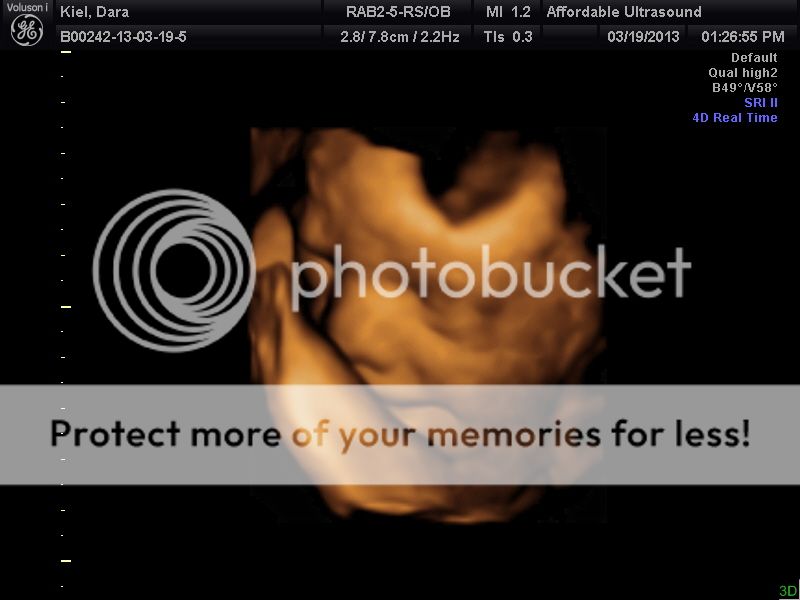 3D Ultrasound @ 27 weeks :) - BabyCenter